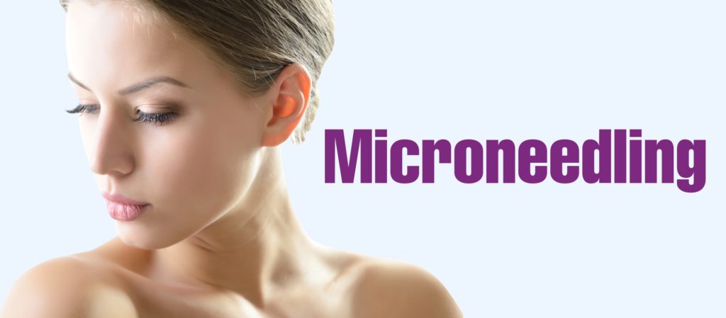 microneedling in Dallas Richardson Plano Allen Southlake Fort-worth Frisco McKinney Texas, dermaroller in Dallas Richardson Plano Allen Southlake Fort-worth Frisco McKinney Texas, dermapen in Dallas Richardson Plano Allen Southlake Fort-worth Frisco McKinney Texas, microneedling pen in Dallas Richardson Plano Allen Southlake Fort-worth Frisco McKinney Texas, micro needle roller in Dallas Richardson Plano Allen Southlake Fort-worth Frisco McKinney Texas, skin roller in Dallas Richardson Plano Allen Southlake Fort-worth Frisco McKinney Texas, skin needling in Dallas Richardson Plano Allen Southlake Fort-worth Frisco McKinney Texas, best derma roller in Dallas Richardson Plano Allen Southlake Fort-worth Frisco McKinney Texas, microneedling cost in Dallas Richardson Plano Allen Southlake Fort-worth Frisco McKinney Texas, face needling in Dallas Richardson Plano Allen Southlake Fort-worth Frisco McKinney Texas, microneedling facial in Dallas Richardson Plano Allen Southlake Fort-worth Frisco McKinney Texas,